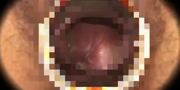 Hidden Spy Medical Movie Only Here