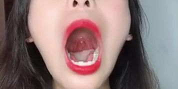 Chinese Uvula