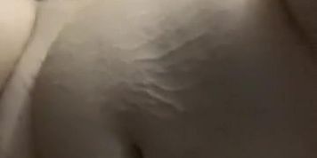 Chubby Girl With Stretch Marks