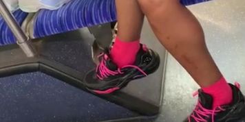 Homless Ebony Mother Let'S Me Record Her Legs And Shows Off For 10$ On Bus