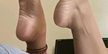 Pelmata patouses