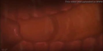 Sex-ed Animatiom - How to inseminate thru cervix