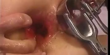 EXTREME ... !!! Impressive Lady !!! She dildoing her peehole