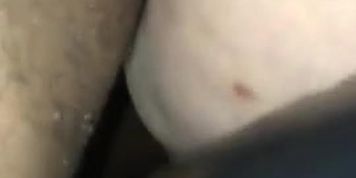anal