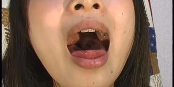 UVULA