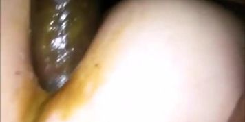 Anal Fucked By Bbc Making Dick Dirty Of Shit