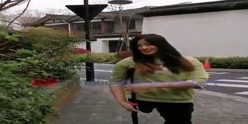 amputee