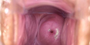 Hot Girl Using Speculum To Show Her Cervix