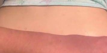 Only Fans - Anna Blossom II