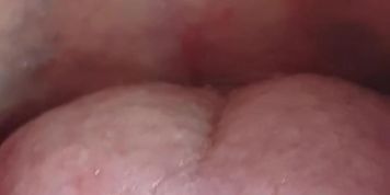 Gf Mouth Fetish Fillings 