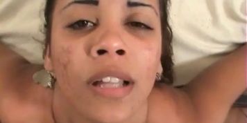 Brazilian faciais