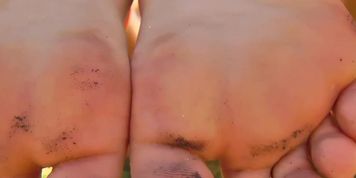 Toe Jam Caked on Feet