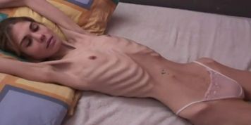 Anorexic Janine 6 (Sylvia Laurent)