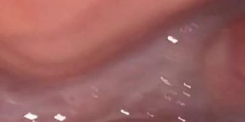 ghhg