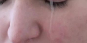 Extreme close up facial of a teen (2014)