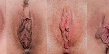 vagina