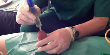 Sub Kevin's First Catheter