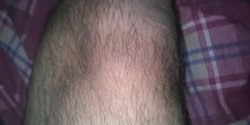 My Stumps