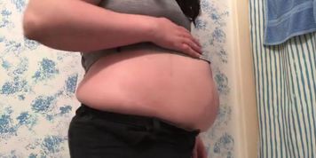 Fat Girl Gets Stretch Marks