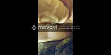 start of my journey to permanent gape