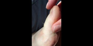 Hairy Girl Rubs Toes With Lotion
