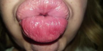 Extreme Pucker