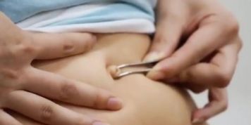 needle navel (Larissa Mendes)
