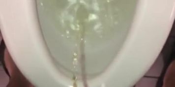 Phimosis pee