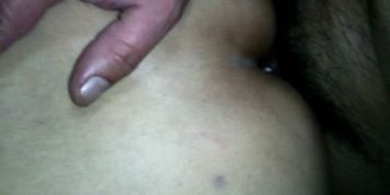 anal mexicana