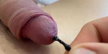 Black urethral plug