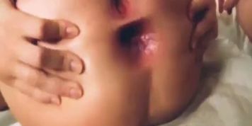 Tight Ass Teen Homemade Intense Anal Screw With Cumshot On Ass