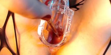 Adalynnx - sounding my cervix and peehole
