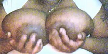 big dark areola