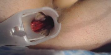 Squirt with speculum in my ass close up