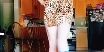 Amputee dance 