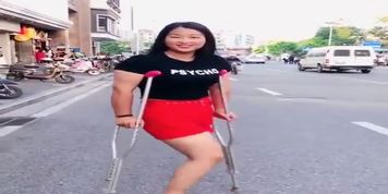 amputee