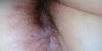 Happy Smiling Flatulent Camgirl Slut Pulls up Cute Dress to Show Hairy Anus Farts Farting!