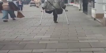 Amputee Sightseeing