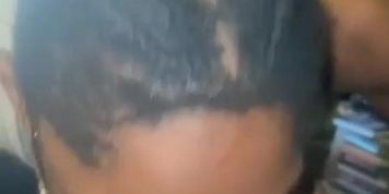 Nappy &ldquo;Head &ldquo;
