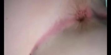 Teen butthole