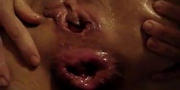Anal Extreme
