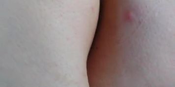 Sexy Flatulence Farting Girl Camgirl Cellulite Ass Pimples Shows You Her Fart! (PinkMoonLust PinkMoonLust)