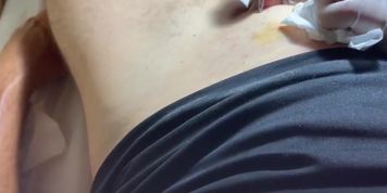 Brazilian Wax For A Big Floppy Cock Part 4 Wax And Tweez