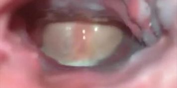 Live Action Hentai 2 Internal Anal Creampie View (Shot Inside Ass hole)