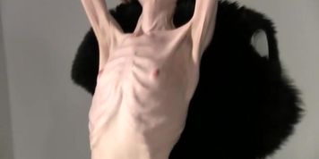 Anorexic Stasha 3