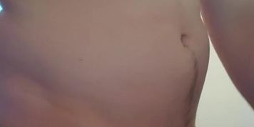 Belly inflation - bloat with mentos and coke