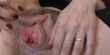Huge Hairy Pussy original exposing closeup