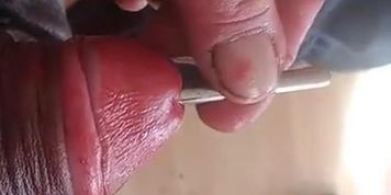 FANTASY PORN - DIRTY GARDENBOY SOUNDING CAROLA SMIT ANAL FIST