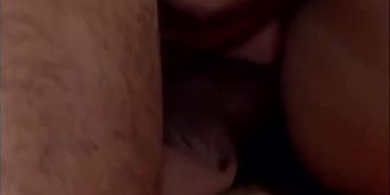 Anal DP