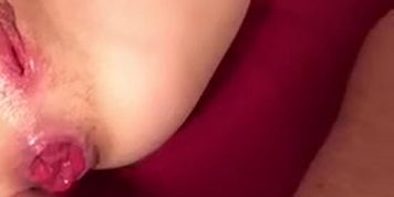 Homemade deep anal prolapse ???????? ???? ? ?????????